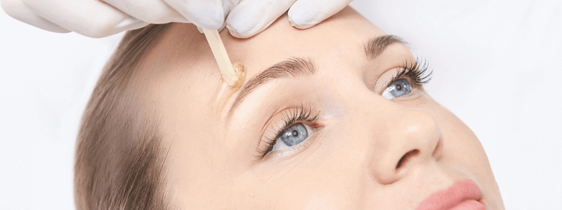 Gesichtshaarentfernung – finden Sie die Methode, die zu Ihnen passt