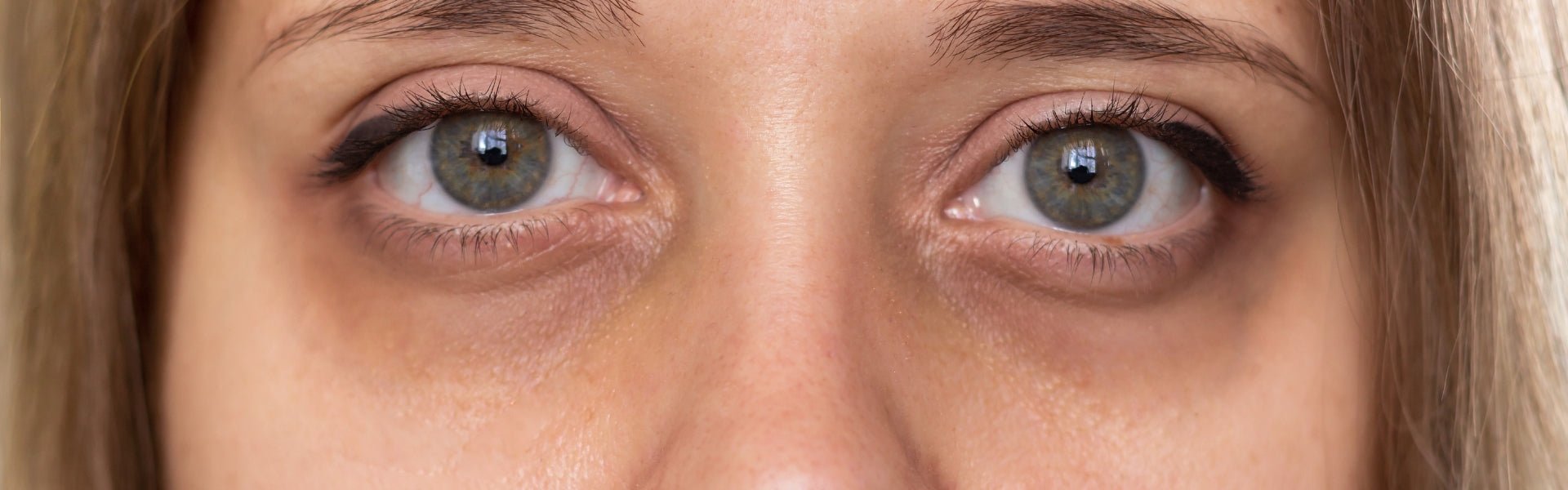 Creme gegen Augenringe ► Hilft sie wirklich?