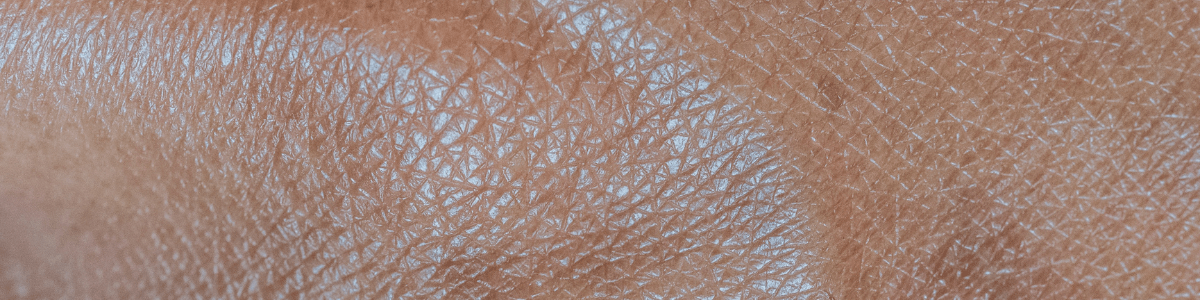 Das (kleine) Lexikon der Hautzustände – Part 2