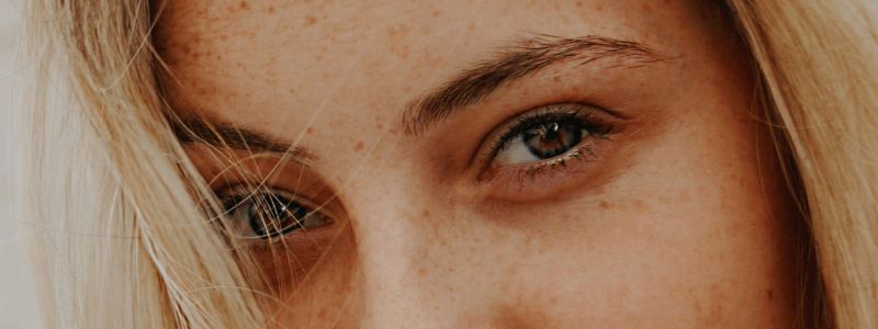 Pigmentflecken im Gesicht? So helfen Gesichtscremes wirklich!